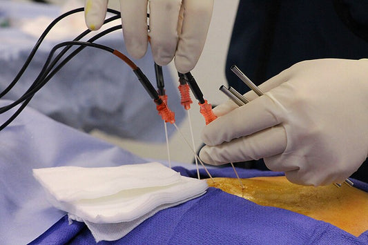 Are Invasive Procedures Effective for Chronic Pain?