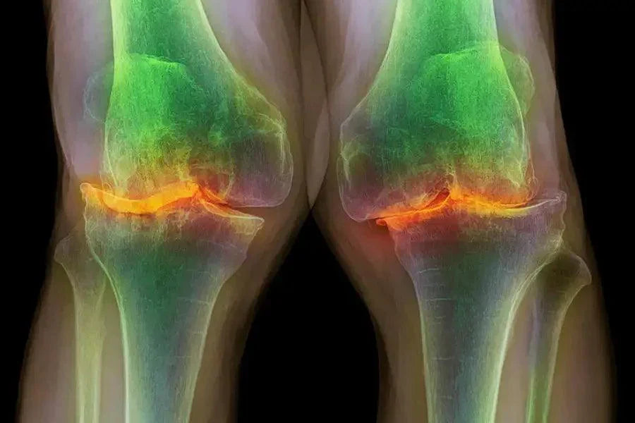 How to increase your knee joint lubricant? | Zanskar Health Blog How to increase your knee joint lubricant? | Zanskar Health Blog