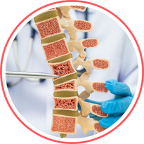 Osteoporosis