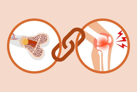 Osteoarthritis vs Osteoporosis: Differences and Similarities