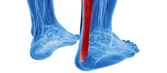 What Is Tendonitis and How Long Does It Last?