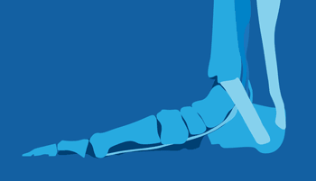 Are your flat feet causing your knee and lower back pain? - Zanskar