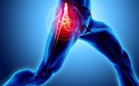 Avascular Necrosis (Osteonecrosis): What is it and why is it on the rise post covid? - Zanskar