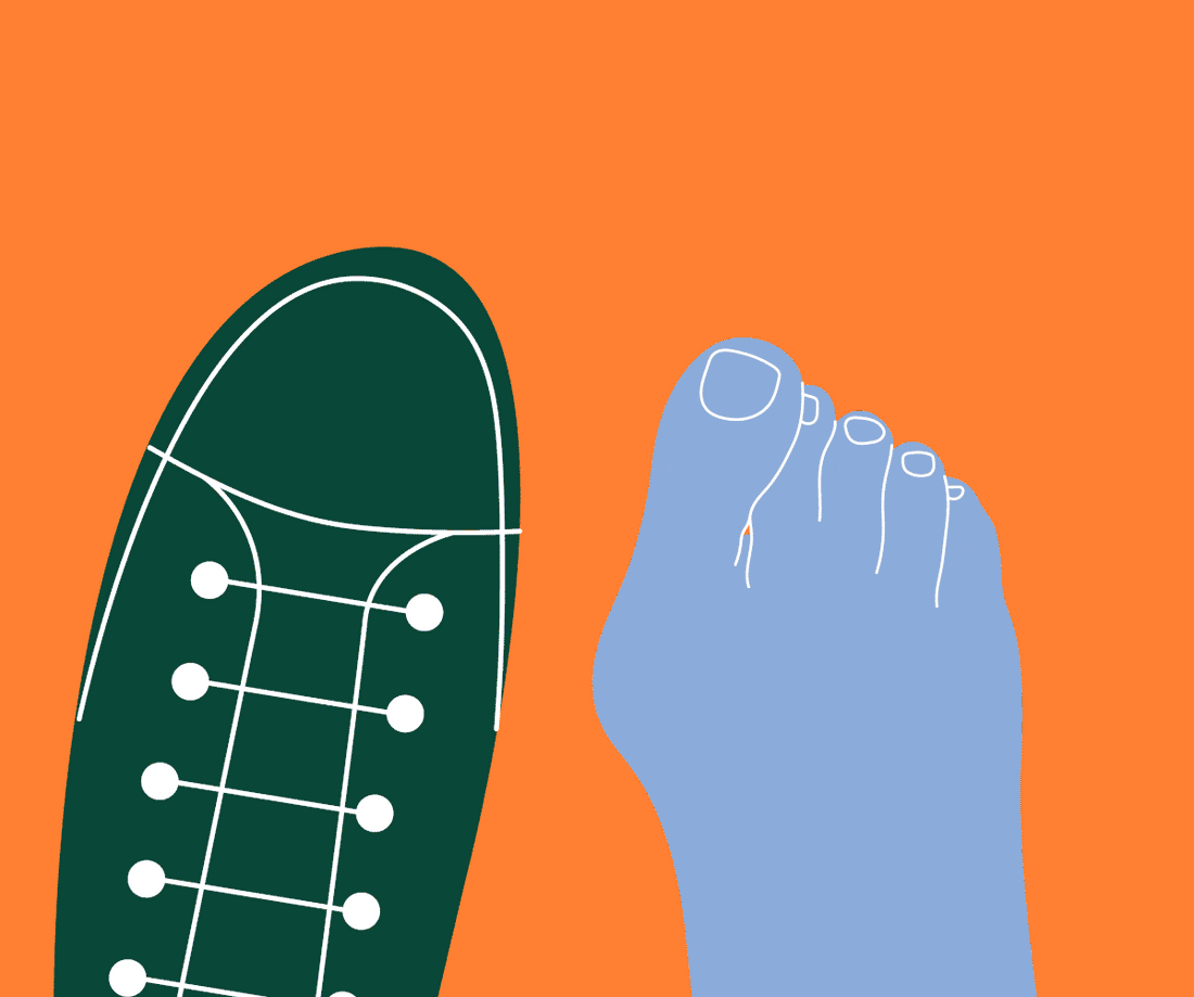 Bunions (गोखरू): What Causes These Painful Toe Deformations and How To Treat It as per Pain Experts - Zanskar