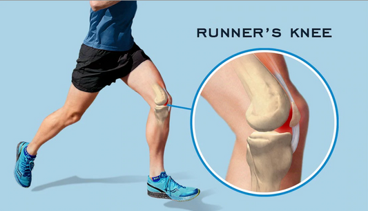 Runner’s Knee: Complete Guide to Causes, Symptoms, and the Smartest Ways to Heal
