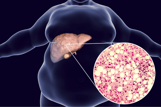 The link between fatty liver and weak bones - Zanskar