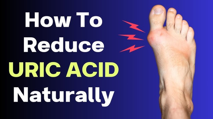 7 superfoods that help reduce uric acid and gout naturally